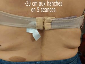 Détox et perte de poids (5 au 9 novembre 2025)